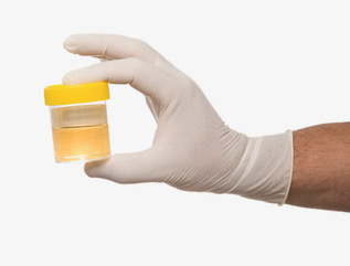 Organic Acid Test (OMX) Urine